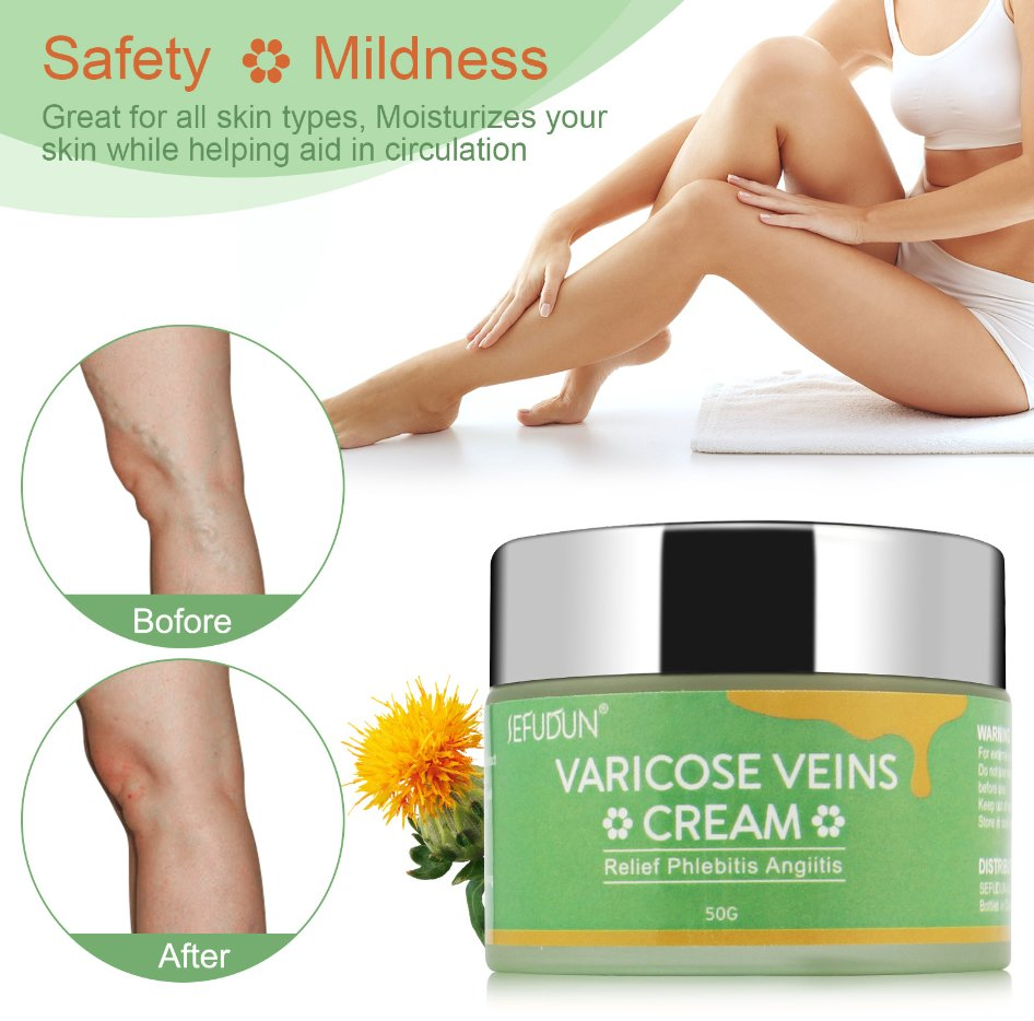 Online Wholesale and Retail Effective Varicocele Treatment Relief Soothing Ointment Original Vasculitis Varicose Vein Removal Repair Cream for Leg