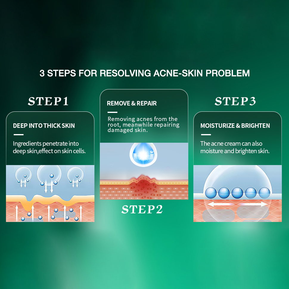 Plant Extract Luxury Anti-Acne Smoothing Salicylic Acid Face Cleansing Cream Plant Extract Anti-Acne Face Cream