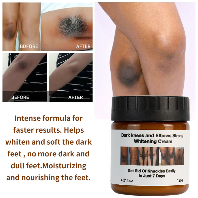 Wholesale Body Care Skin Whitening Creams Anti Dark Spot Wrinkle Knees Elbows White Lotion Moisturizer Body Whitening Cream