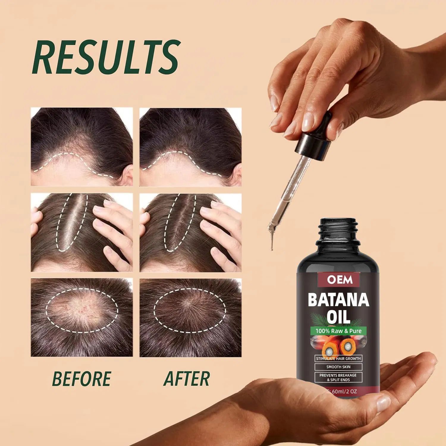 100% Raw Pure Hair Growth Oil Batana Prevents Oil