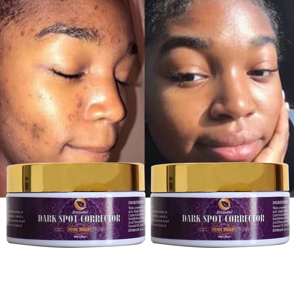 Hydrating Anti Dark Spot Whitening Lemon Face Cream for Adults Aloe Moisture Anti Aging Brighten Skin Cream