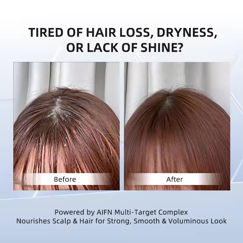 Loss Relief Shampoo for Thinning Hair Growth Strengthening Clean Scalp Treatment