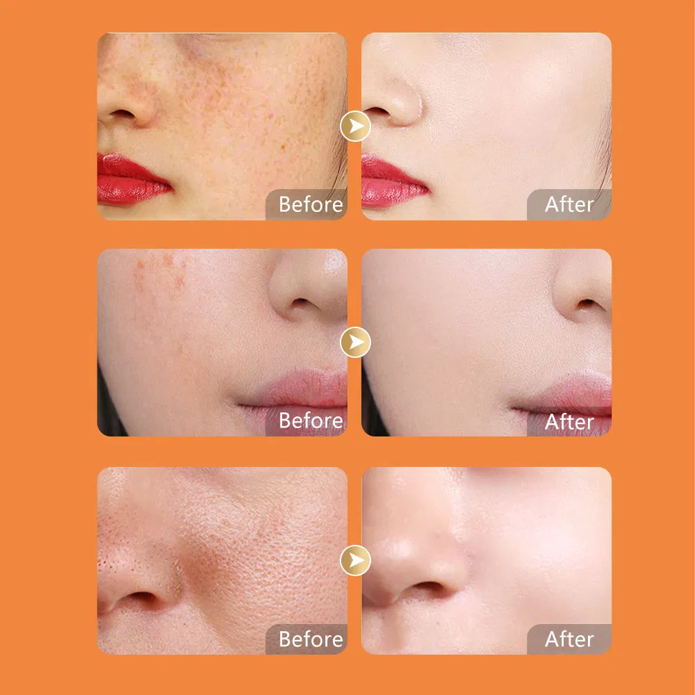 100% Organic Vitamin C Face Care Set for Radiant Skin