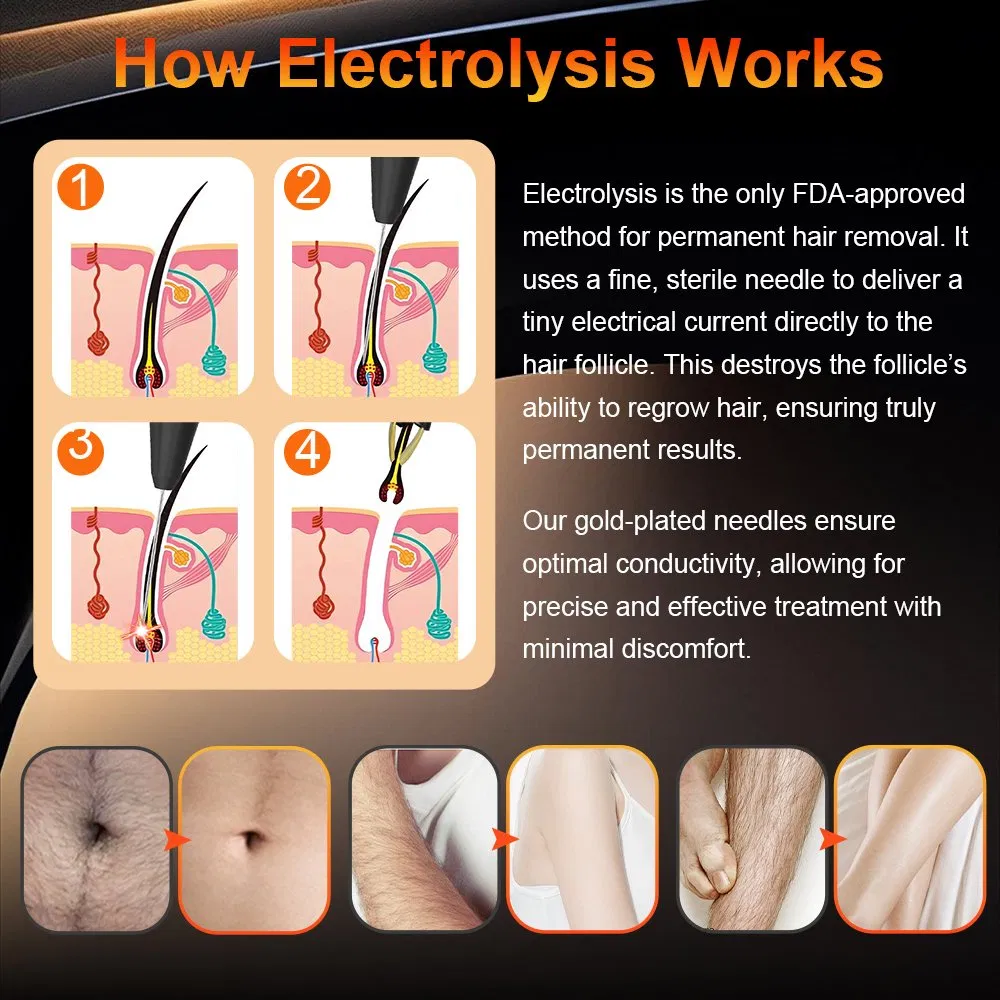 OEM ODM Electric Needle*K4 Insulated Hair Removal Spare Parts 100*Needle Tips Hair Electrolysis for Salon SPA