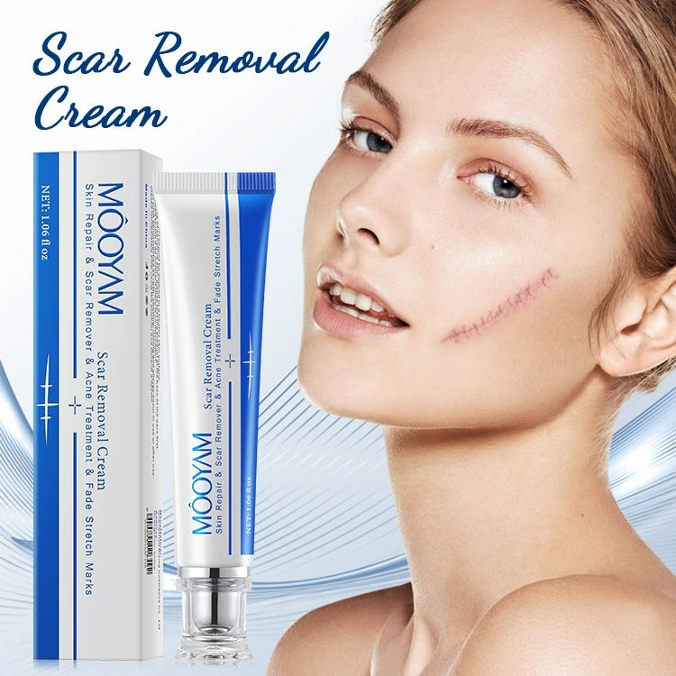 Strong Effective Acne Scar Cream Pimples Stretch Marks Face Cream