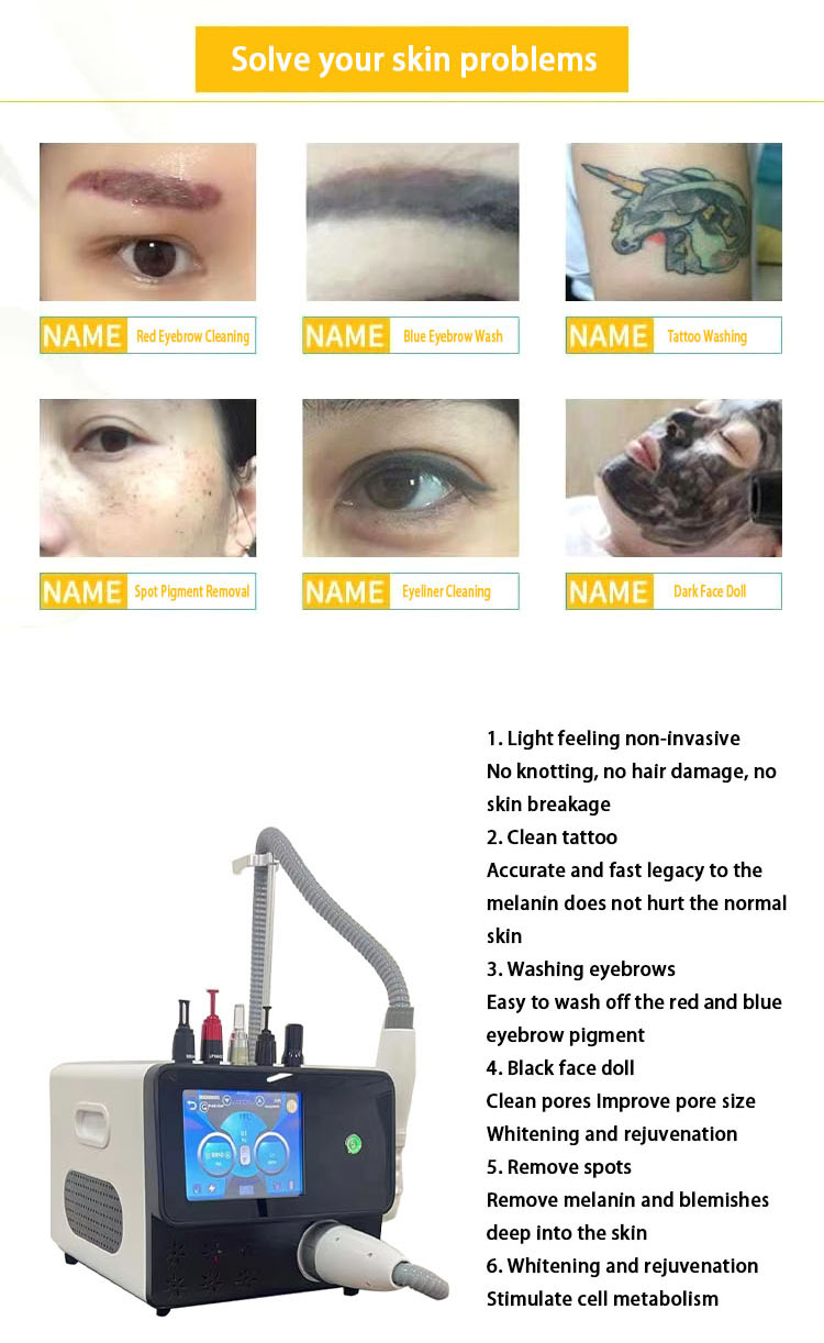 Picolaser Tattoo Removal Pigment Removal Machine Skin Whitening Picosecond Laser with CE Approved