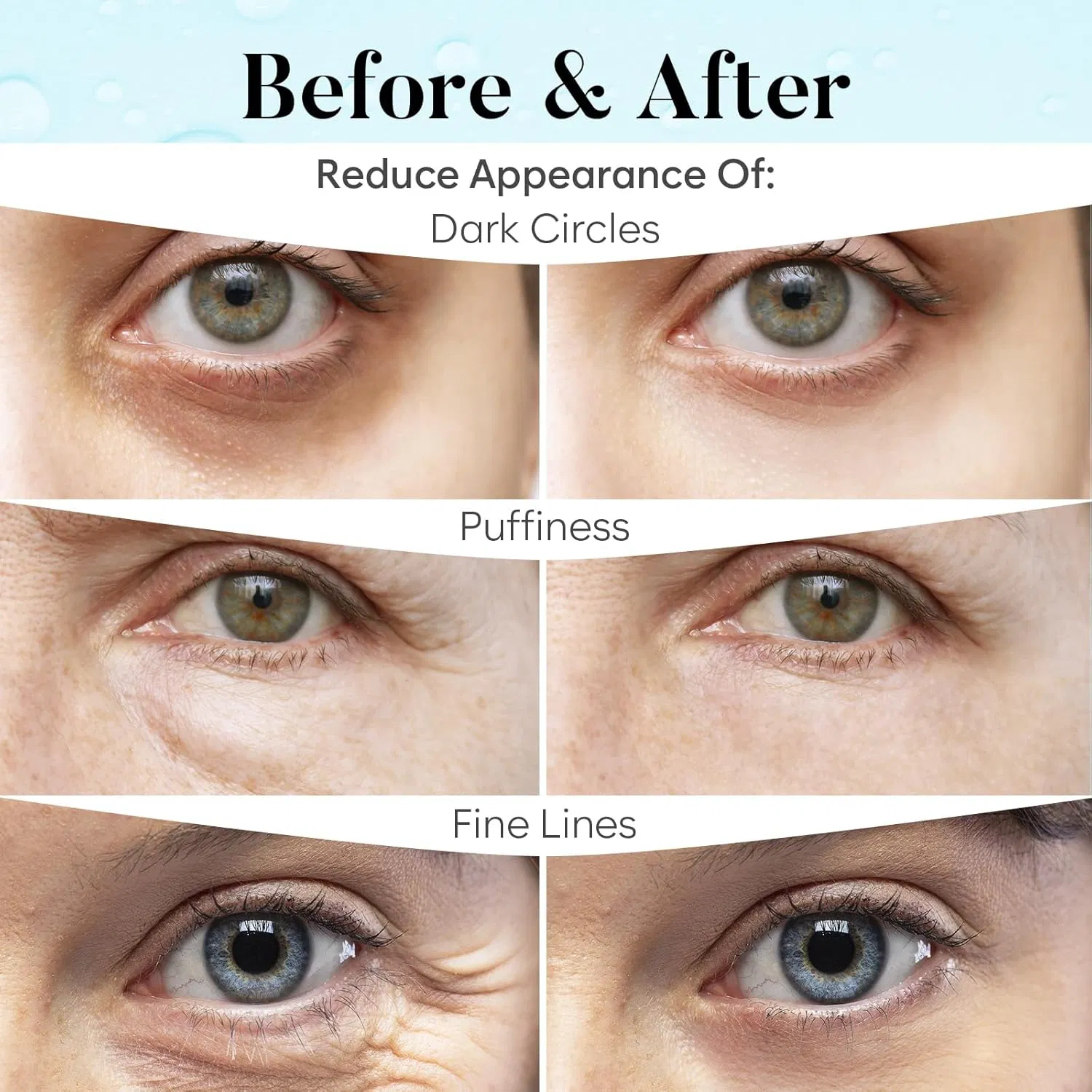 Deeply Moisturize Eye Contour Soothe Dryness & Refresh Tired Eyes Eyemask