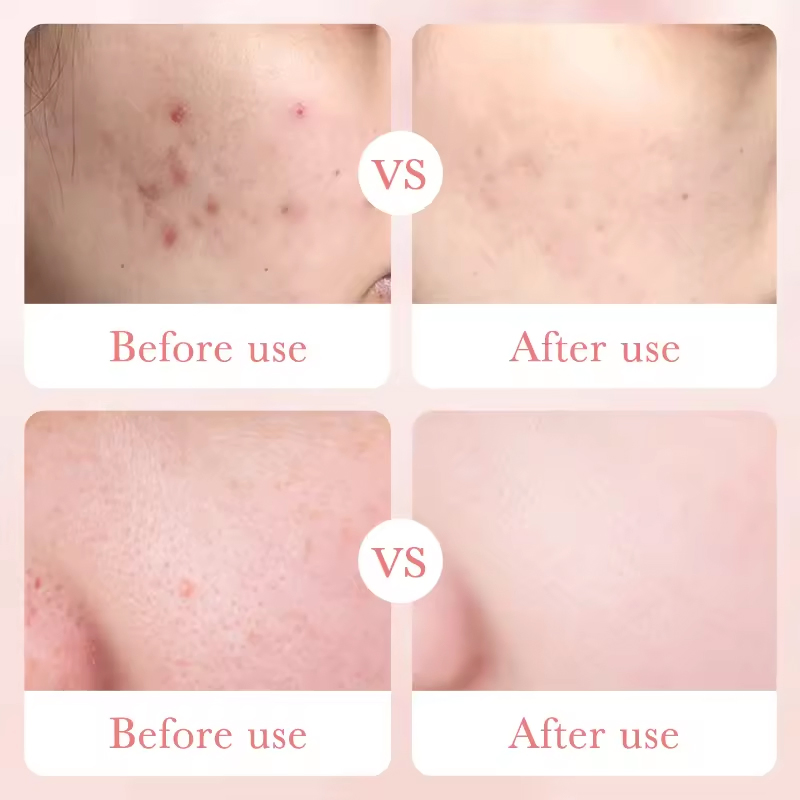 Ditong OEM ODM Beauty Care Rose Hyaluronic Acid Moisturizing Face Cream