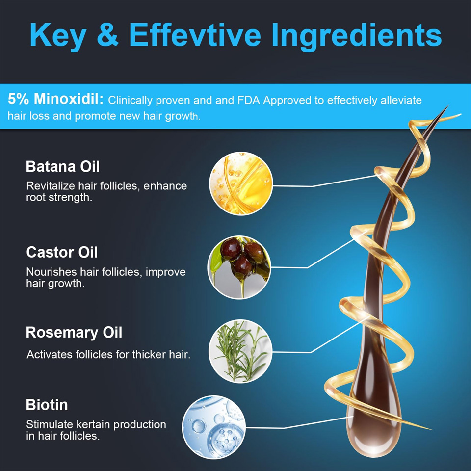 Factory OEM Private Label Hair Growth Serum with Biotin Minoxidil Rosemary Oil Anti Hair Lose