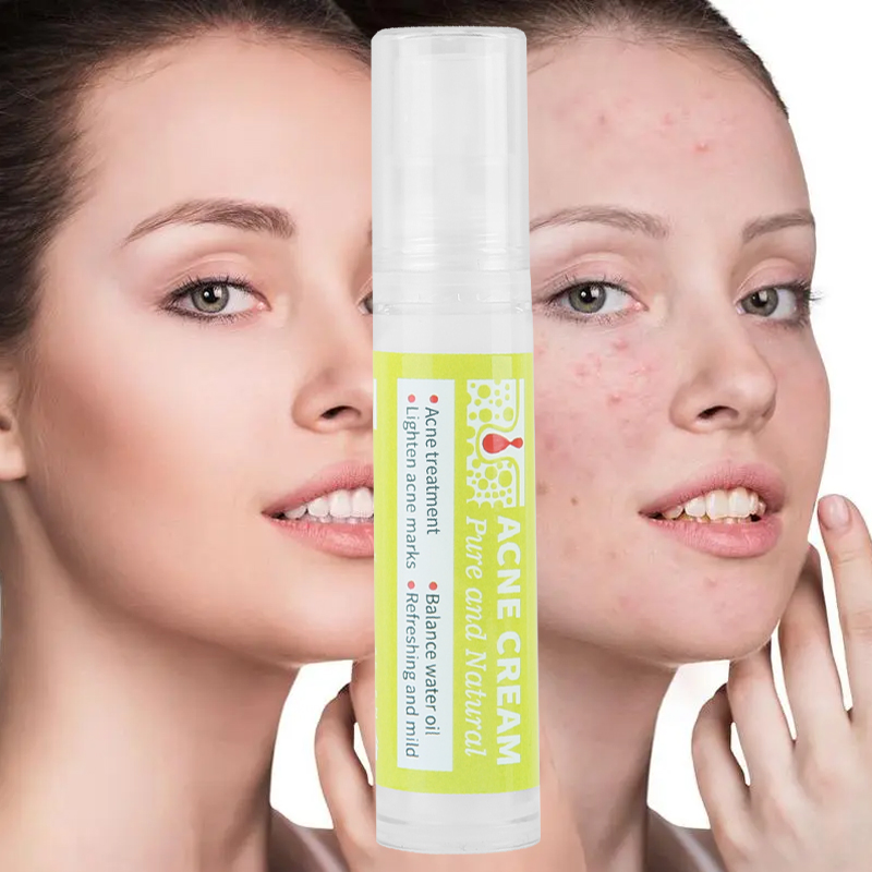 Natural Organic Oil Control Shrinks Pores Woman Skincare Deep Cleansing Acne Cream