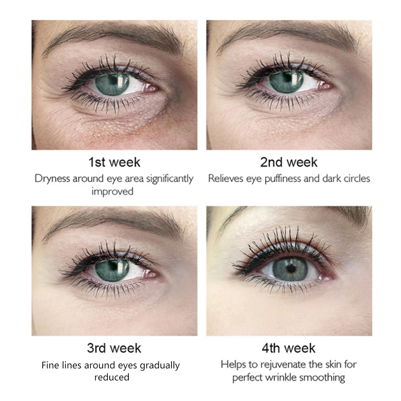 Customize Label Remove Dark Circle 100% Pure Coconut Moisturizing Patch Eye Mask Gel Pads Jelly Eye Patches