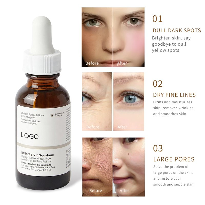 Smoothing Skin Vitamin a Effectively Reduces Fine Lines Anti-Aging Facial Essence