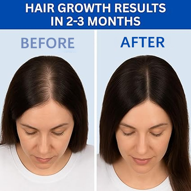 B Blue Copper Peptide Scalp Nutrient Solution Hair Strengthening Serum with Follicle Activation Scalp Repair Anti-Inflammation