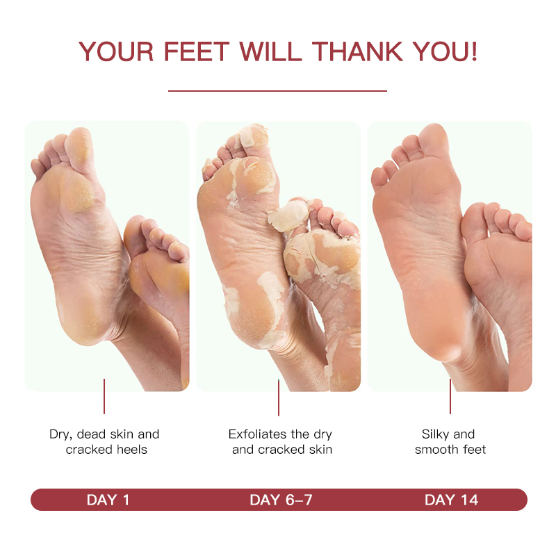 Beauty Cosmetics Skin Care Moisturizing Treatment Peach Kernel Exfoliating Foot Peel Mask