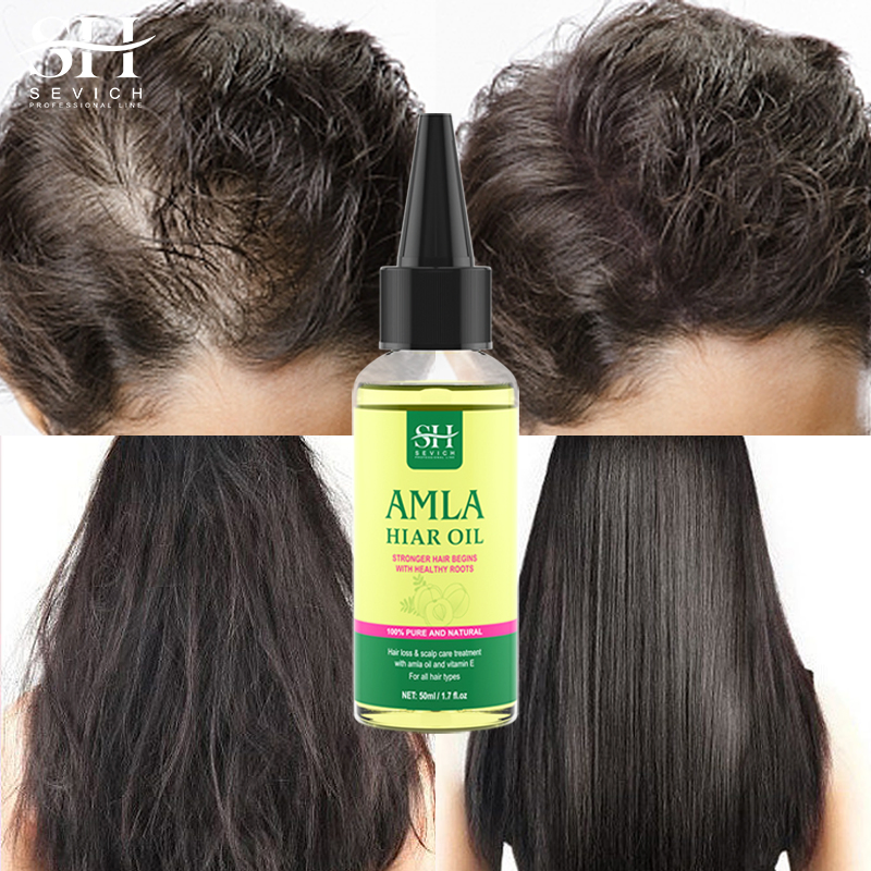 Hot Sell Hair Care Loss Treatment Amla Hair Growth Serum Oil