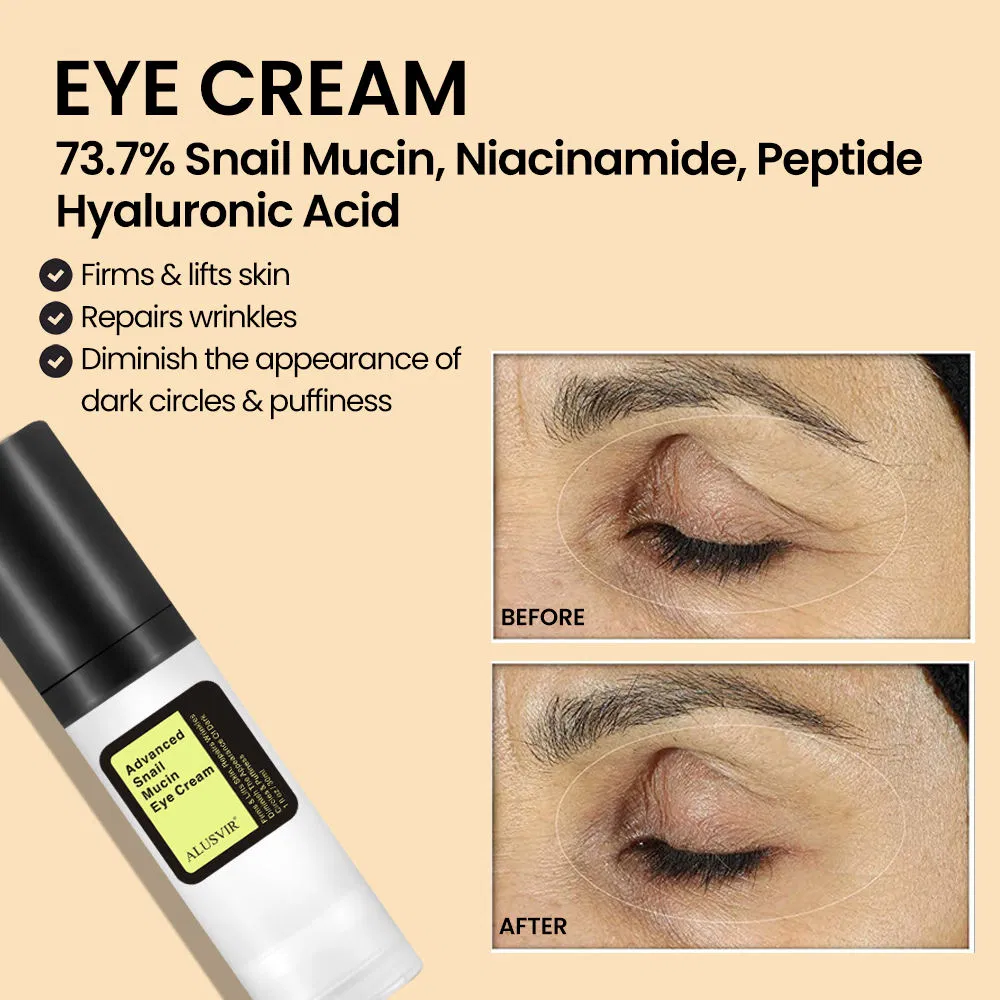 73.7% Snail Skin Eye Cream Anti Wrinkles Lifting Firming Eye Cream