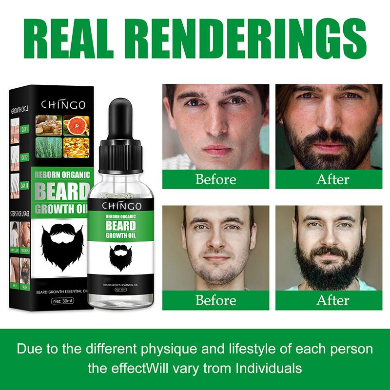 Thicker Anti Loss Moisturizing Softening Beard Growth Oil Fast Absorption