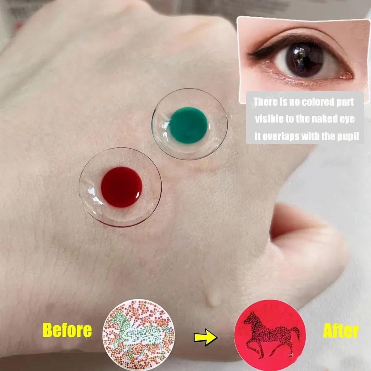 Color Blind Contact Lenses Improve Color Vision and Hue Discrimination of Patients with Red and Green Color Blindness