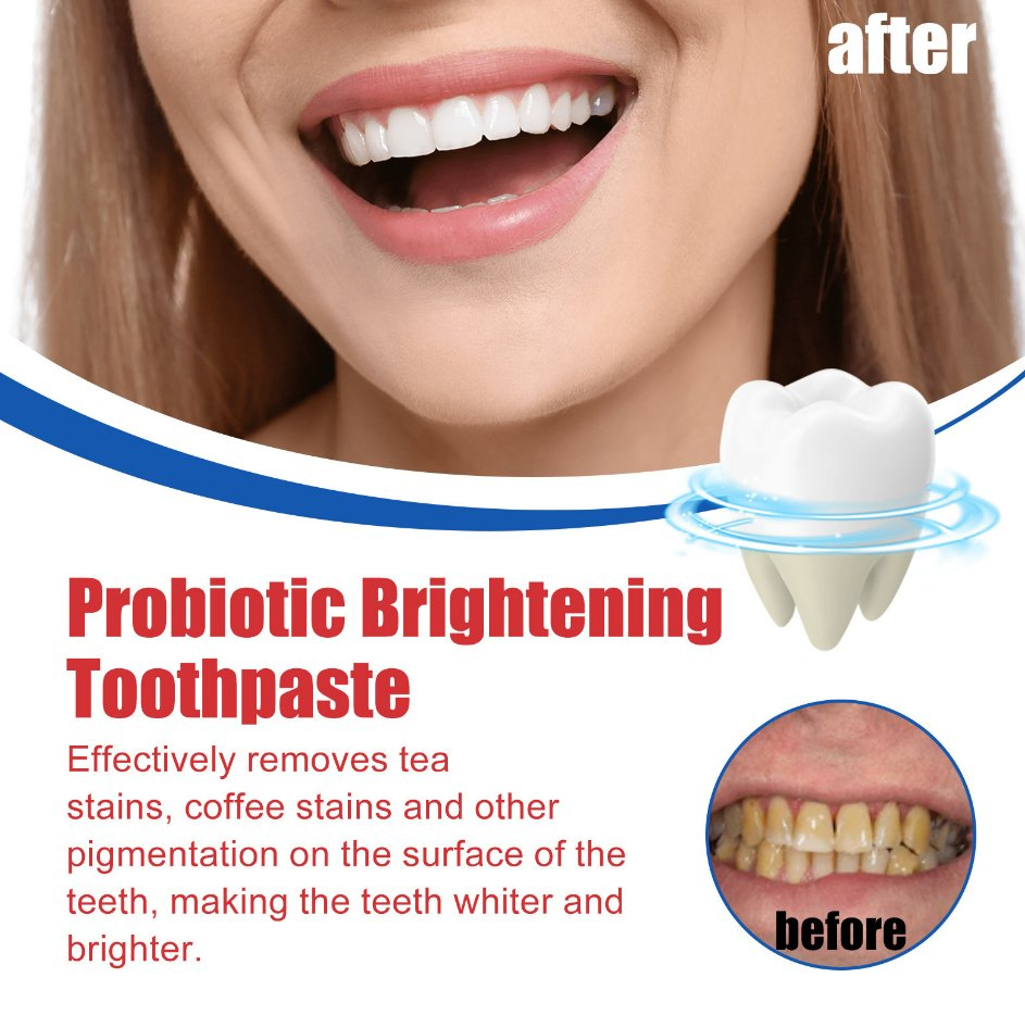 Отбеливающая зубная паста SP-6 Probiotic, 120г