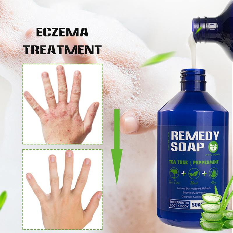 Mint Tea Tree Shower Gel Soothes Itchy Skin
