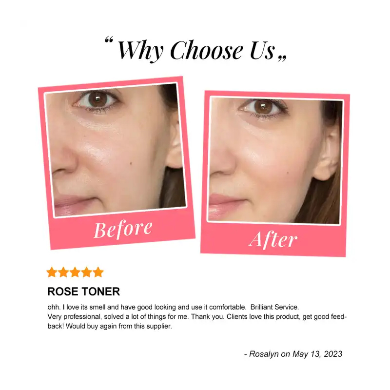 Ditong Private Label OEM/ODM Moisturizing Skin Care Skincare Natural Organic Pure Rose Water Facial Mist Face Toner Spray for Face