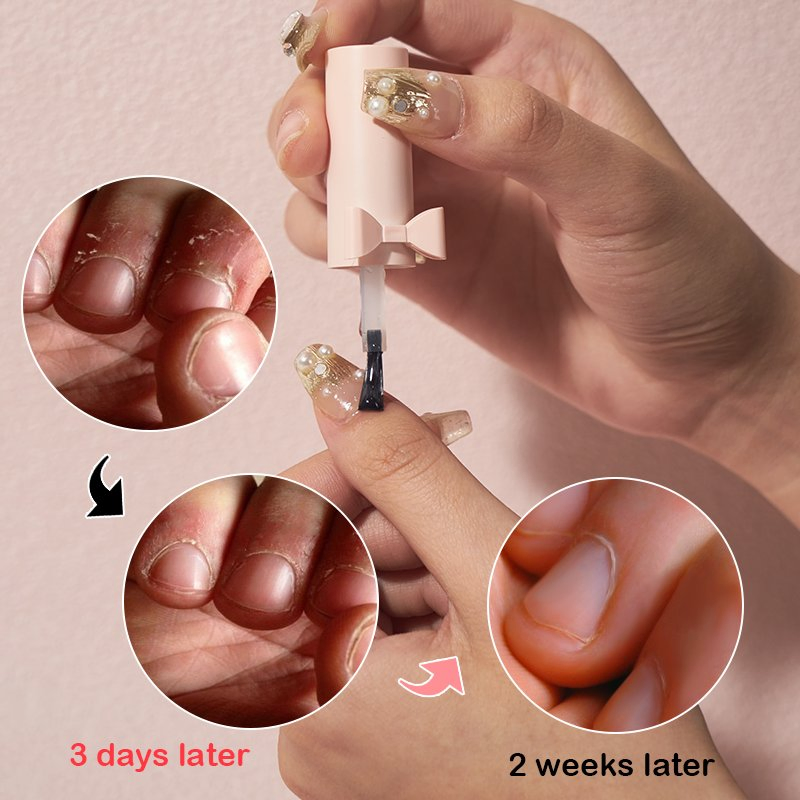Deep Moisturizing Nail Edge Skin Reduce Hangnail Troubles Rose Fingernails Essence Oil