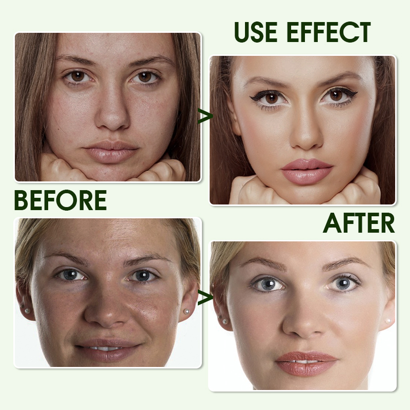 Private Label Moisture Whitening Anti-Aging Soothing The Skin Avocado Skincare Series