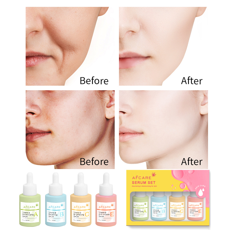 Private Custom Logo MSDS Nature Organic Vitamin Face Serum with Niacinamide Brightening Anti Aging Facial Serum Kit
