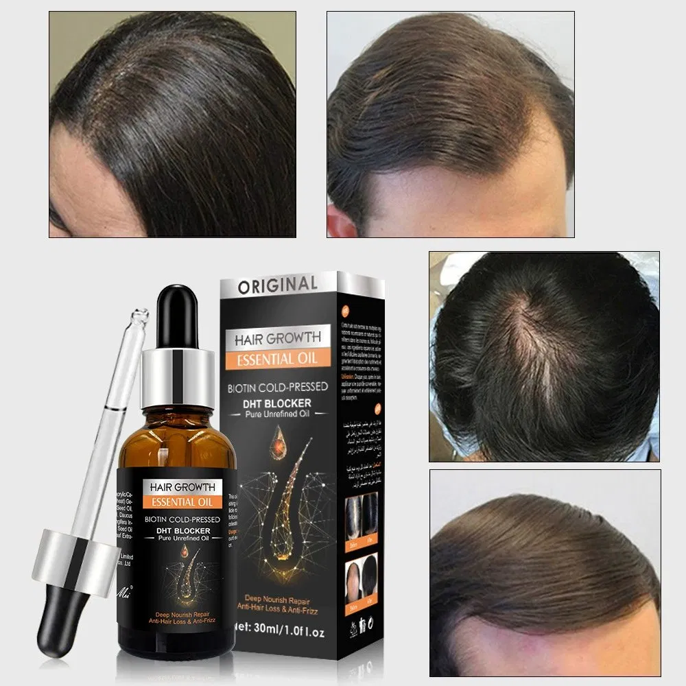 OEM/ODM Wholesale Organic Ginger Hair Essential Oil Natural Herbal Leave-in Scalp Care
