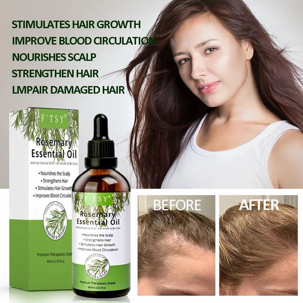 Directly Factory 100% Natural Rosemary Hair Growth Oil Hair Care Purify Scalp Essential Oil OEM/ODM