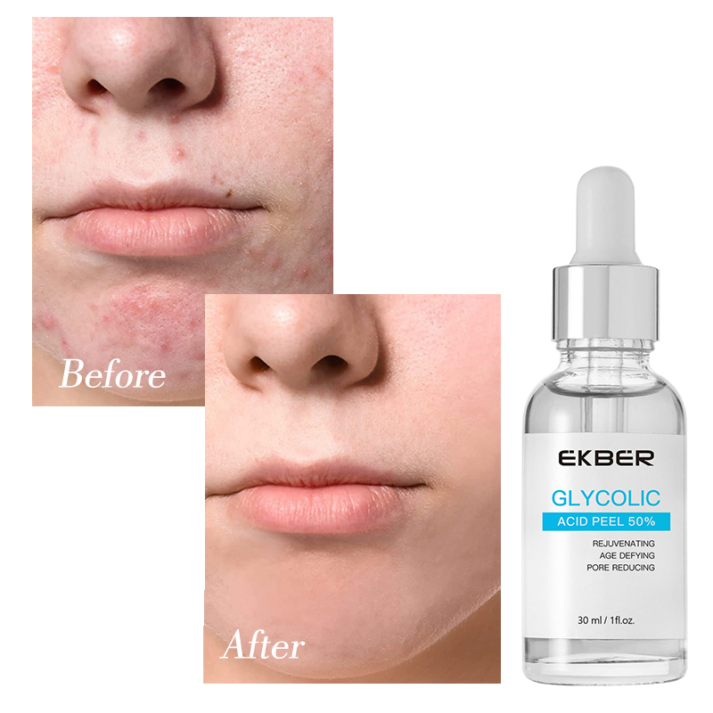 Tiktok Top Sale Brightens The Skin Exfoliating 50% Glycolic Acid Peel Serum Glycolic Acid Solution Skin Care Serum