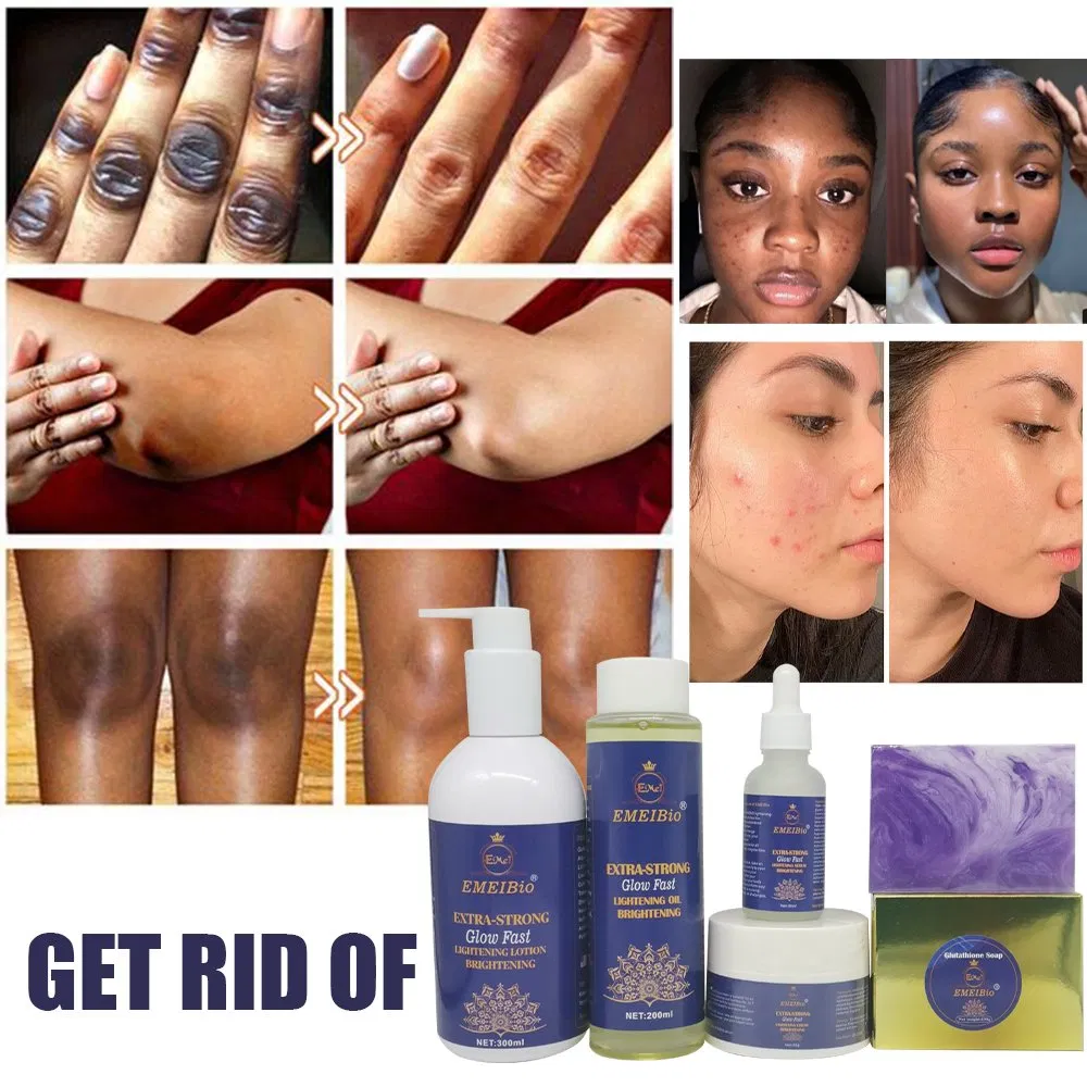 OEM Anti Acne Glutathione Whitening Skin Sets Antioxidant Repair Skin Beauty Brighten Face Sets