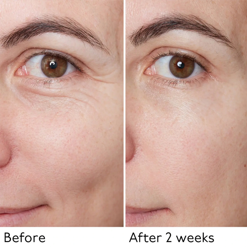 Ditong Chinese Snake Venom Peptide Freeze-Dried Eye Patch