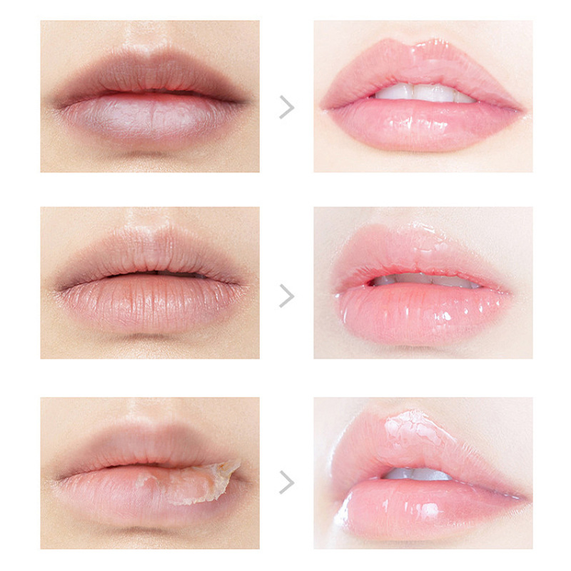 Vitamin E Lip Care Fruit Lip Balm Base Moisturizing Lip Balm