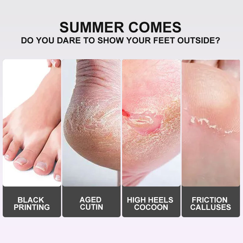Beauty Cosmetics Moisturize Remove Dead Skin Lavender Exfoliating Foot Peel Mask