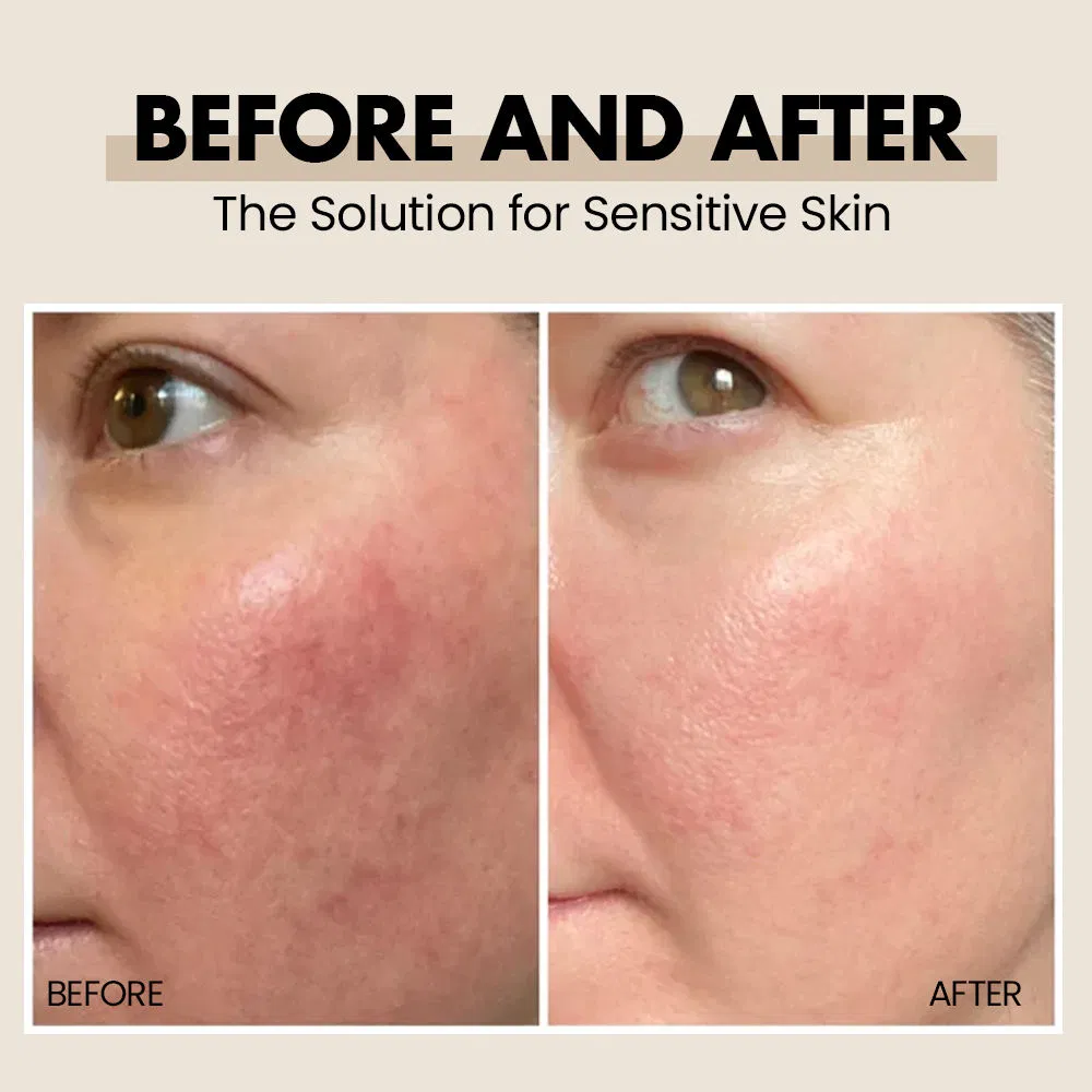 Redness Sensitive Skin Repair Water Hydrating Moisturizing Facial Toner