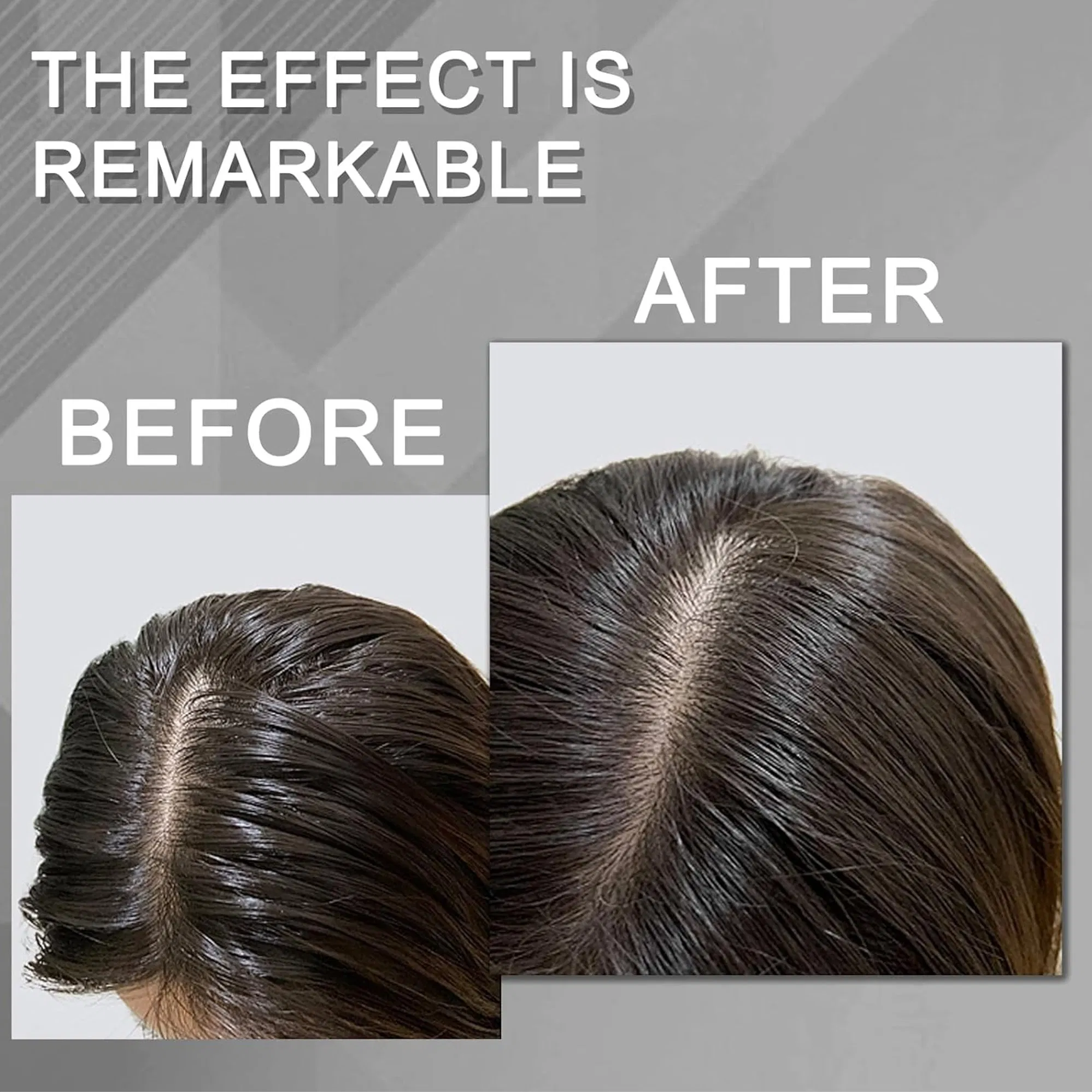 Private Label Hair Care for Dry Hair Shampoo Manufacturers for Oily Control Eco-Friendly Water Free Volumizing Dry Shampoo Spray