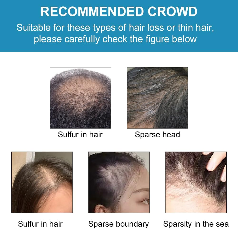 Stimulate Hair Regrowth Fuller Thicker Mane From Natural Nourishment