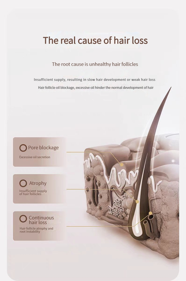 OEM/ODM Custom Polygonum Multiflorum Nourishing Hair Shampoo Deep Hydration Root Strengthening and Hair Care Shampoo