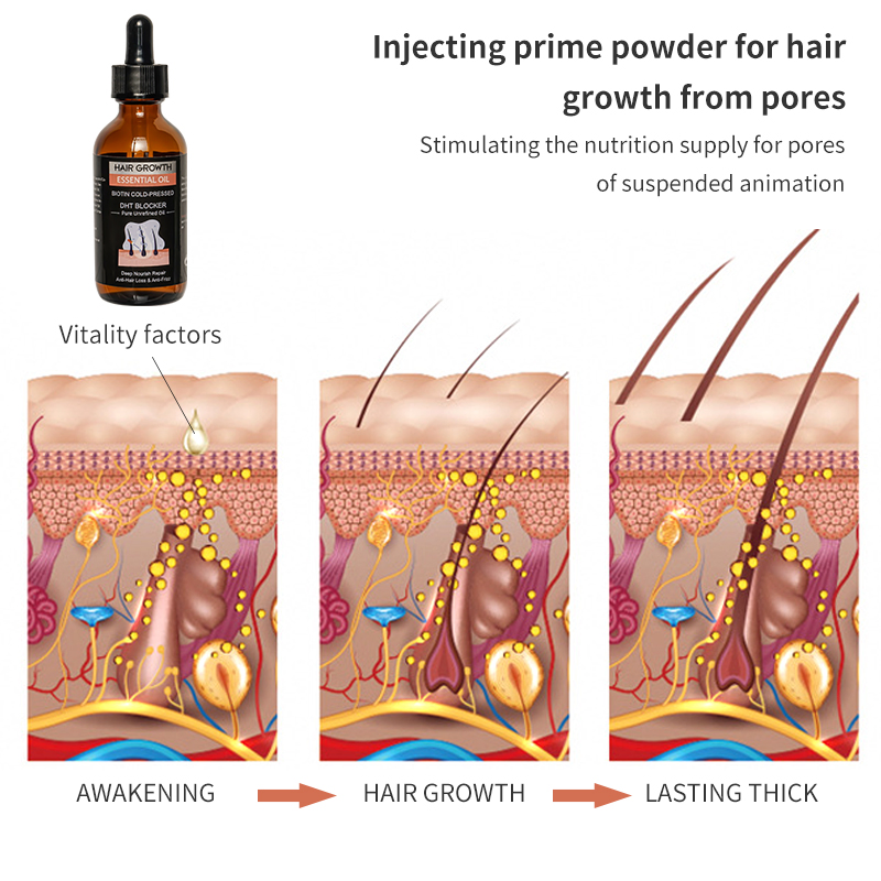 Deep Nourishing Scalp Activate Hair Follicle Unclog Pores Hair Growth Essential Oil