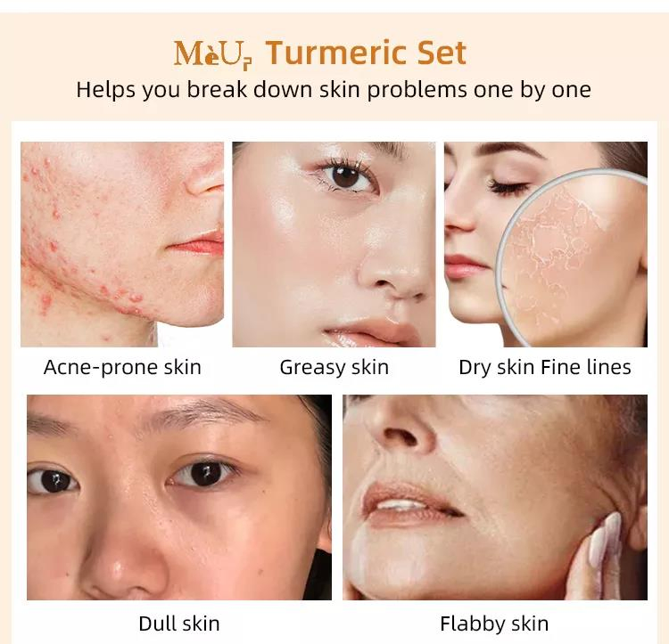 Cosmetics Beauty Turmeric Soap Mask Cream Serum Body Scrub Lotion Turmeric Skin Care Set