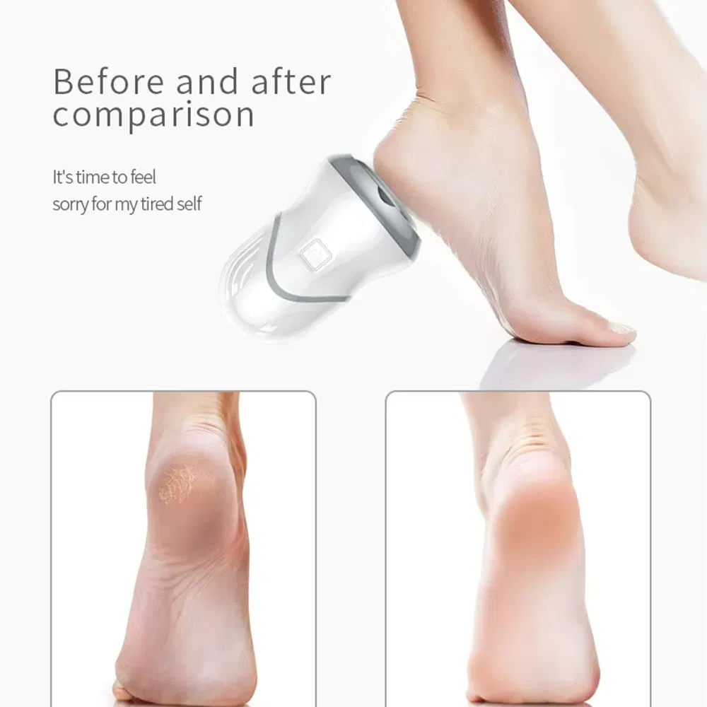 Best Seller Cordless Feet Care Pedicure Set Foot Clean Callus Tools Remover