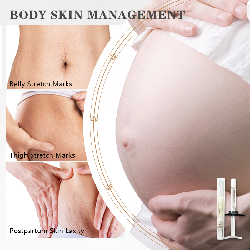 OEM Body Face Oil Natural Organic Scars Stretchmarks Skincare Hydrates Skin Anti Stretch Marks Scar Stretch Marks Repair Kit