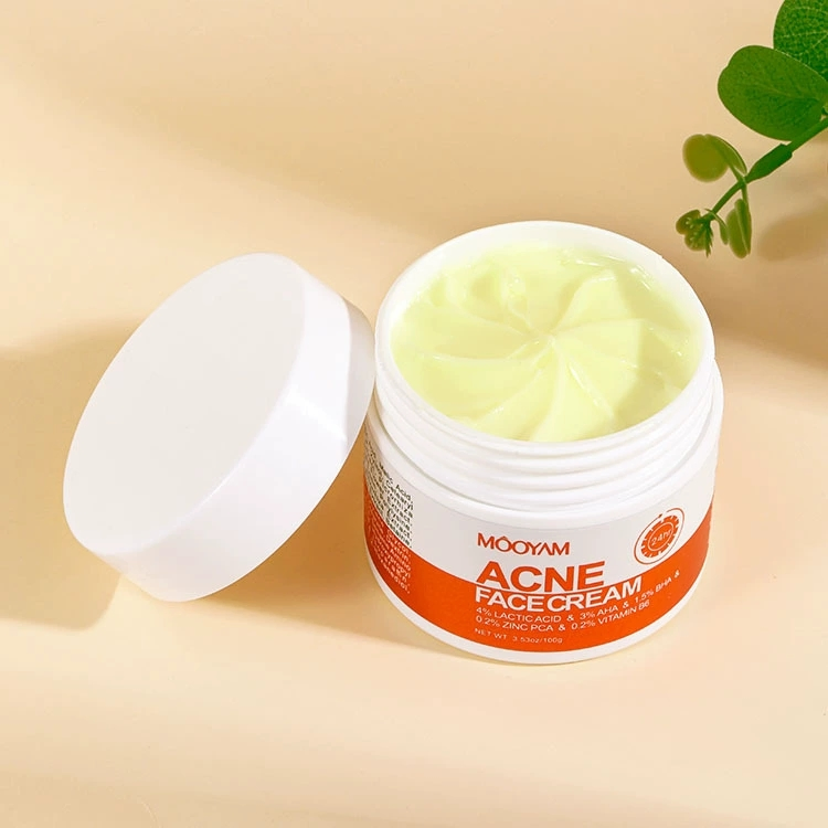 Fast Effective Acne Removal Cream Herbal Pimples Remove BHA Salicylic Acid Face Cream