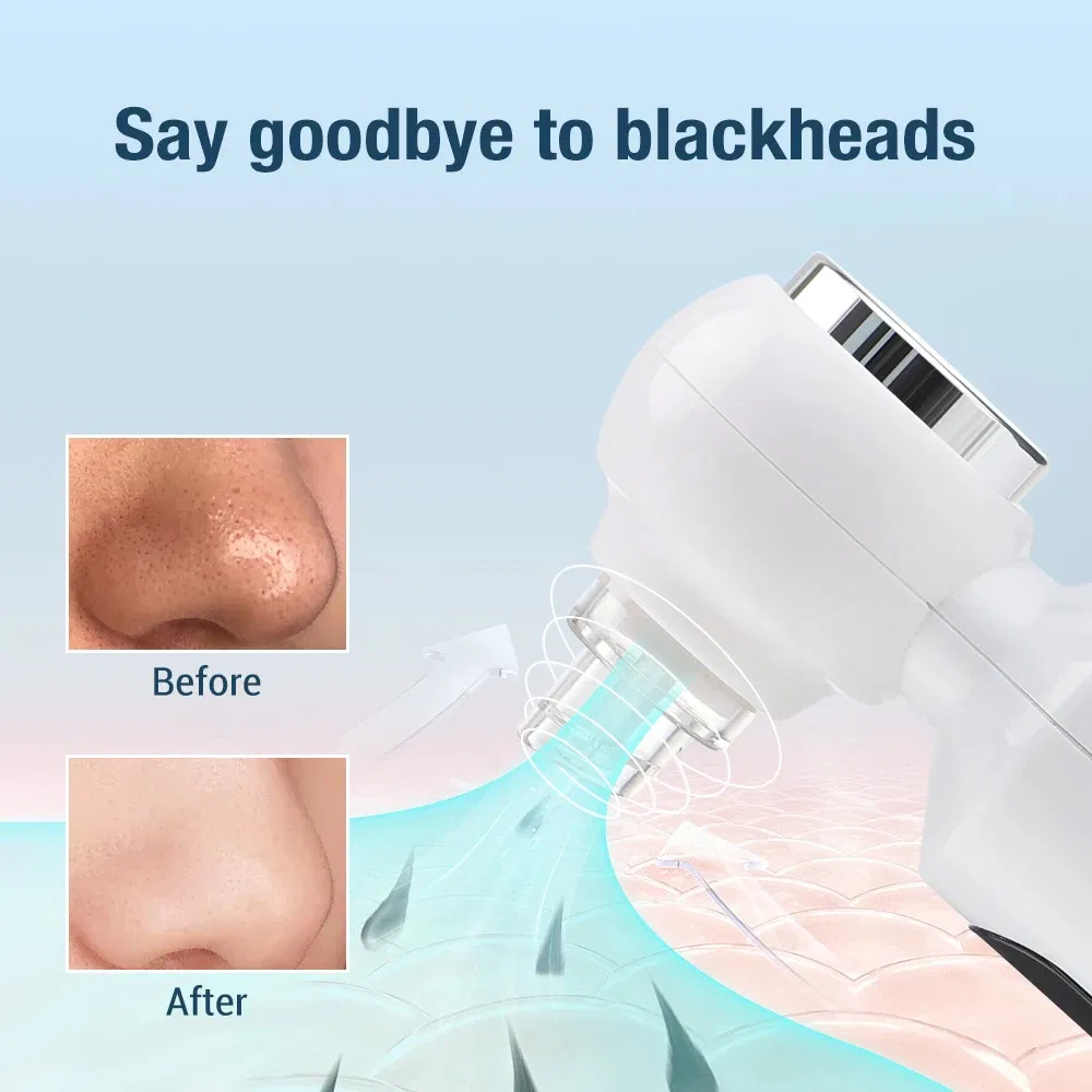Electric Hot Compress Instrument for Pore and Blackhead Care