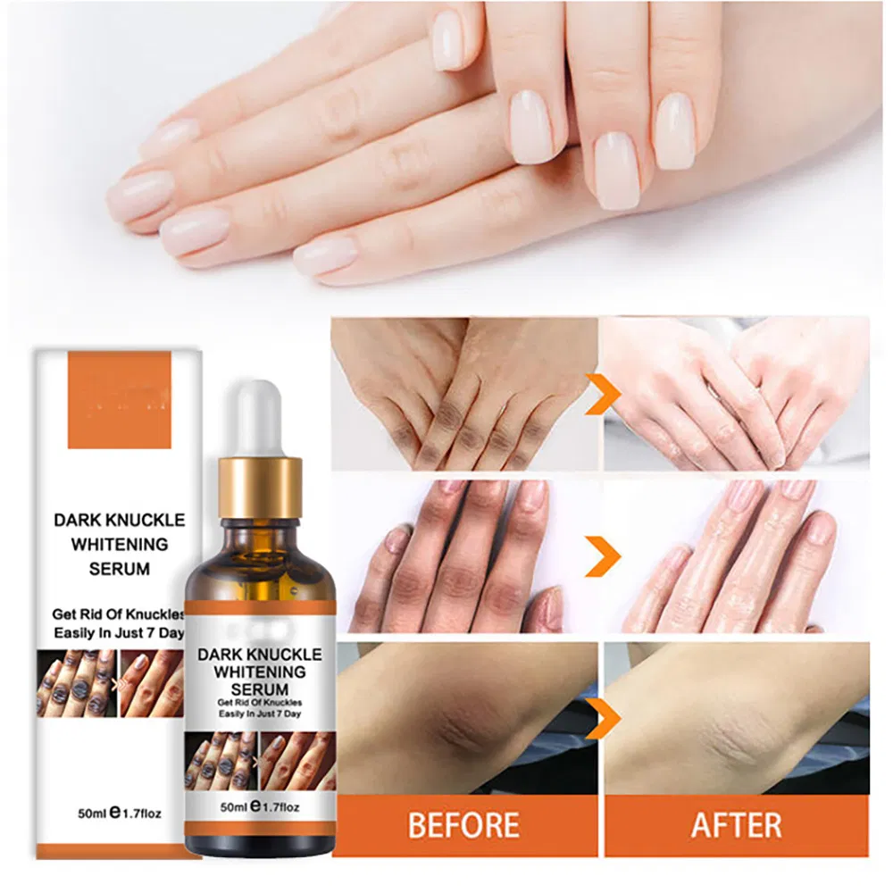 Own Brand Whitening and Exfoliating Joint Essence Nicotinamide to Dull and Brighten Skin Joint Essential Oil