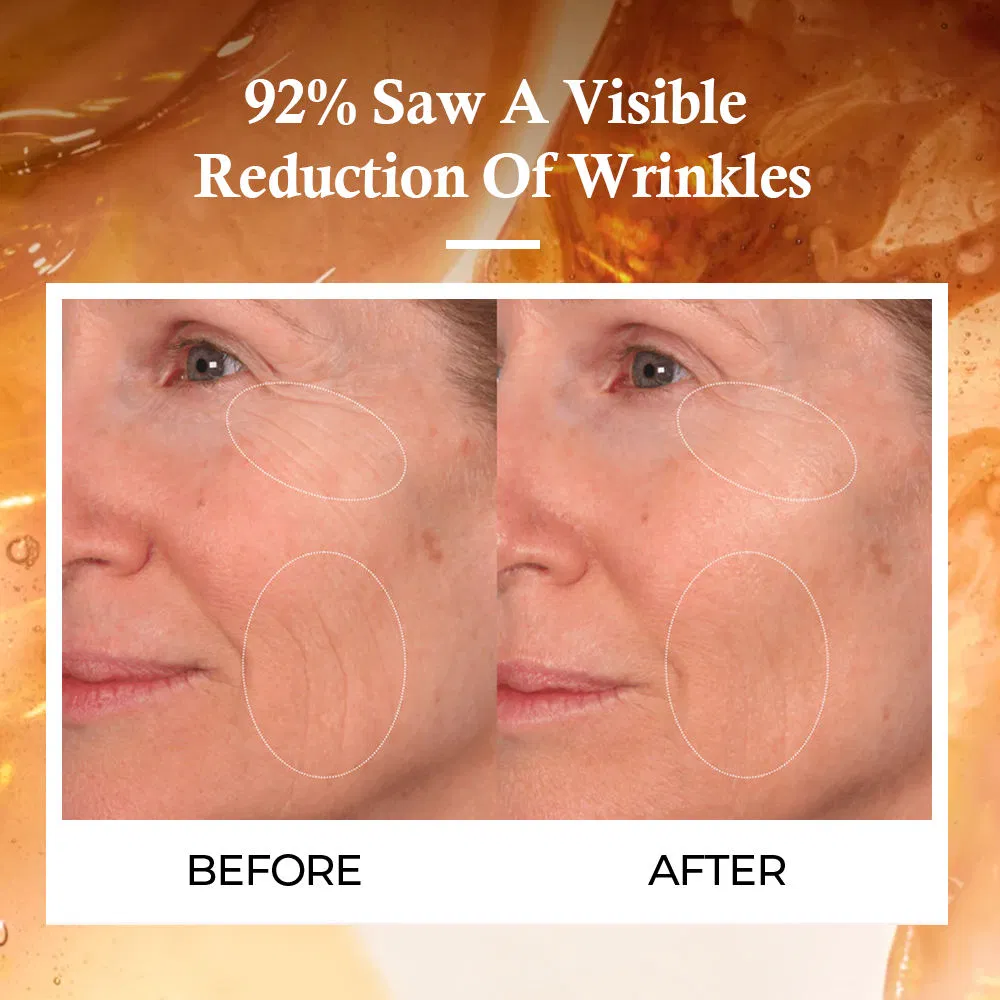 Nad Mitochondrial Cell Anti-Aging Wrinkle Eye Bags Removal Under Eye Cream