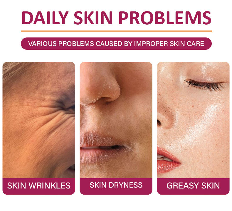 Custom Label OEM Acne Remover Whitening Moisturizing Brightening Search Pore Acid 7% Retinol 3% Facial Toner