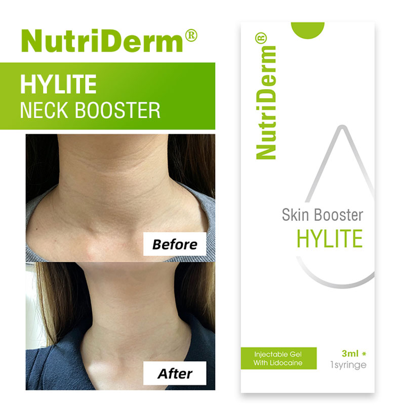 Neck Wrinkle Removal Lightening Tightening Serum Skin Booster Injectable Skin Rejuvenation