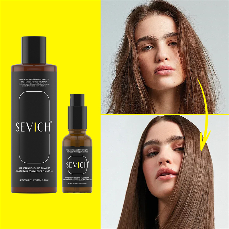 Hair Shampoo Set Wholesale Biotin Rosemary Hair Growth Serum Ginger Natural Anti Hair Loss Essential Oil and Shampoo